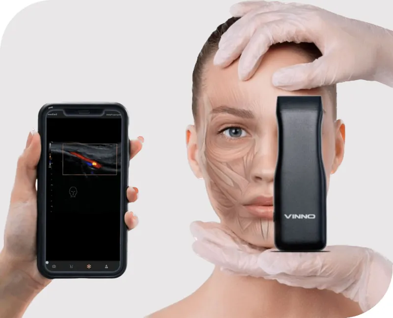 Ultrasound assessment during a filler dissolving appointment