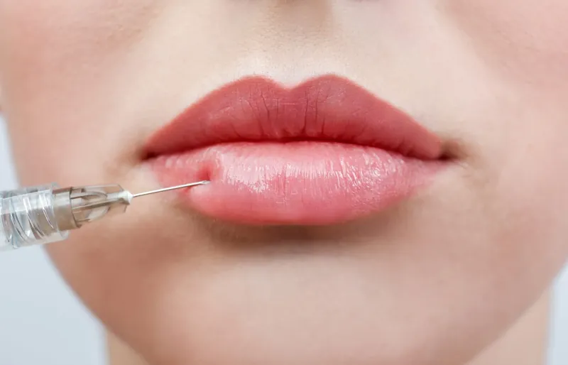Natural and Russian Lip Enhancements