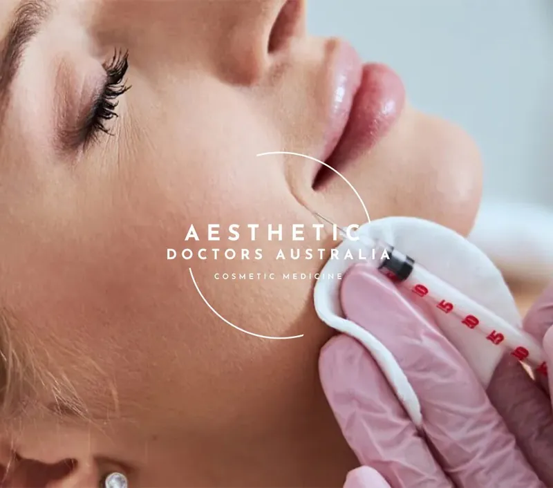 Facial profile study from the practice's volume treatment imagery