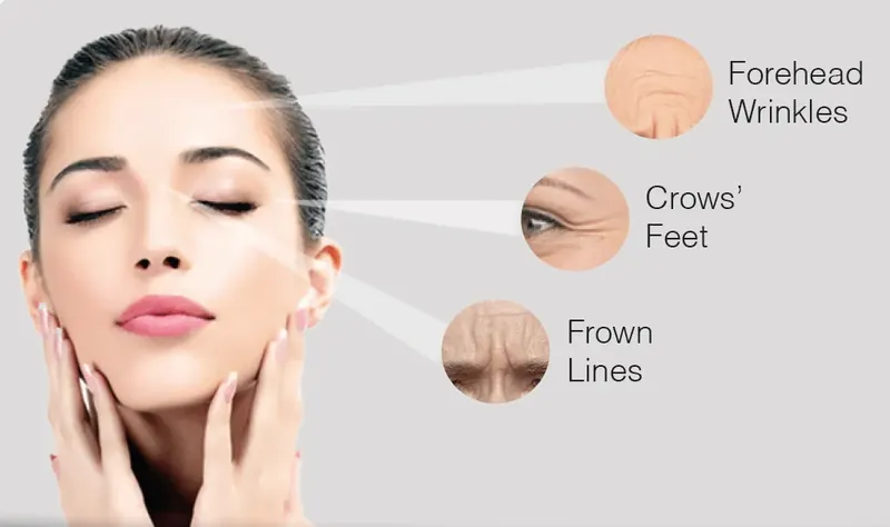Get Rid of Frown Lines