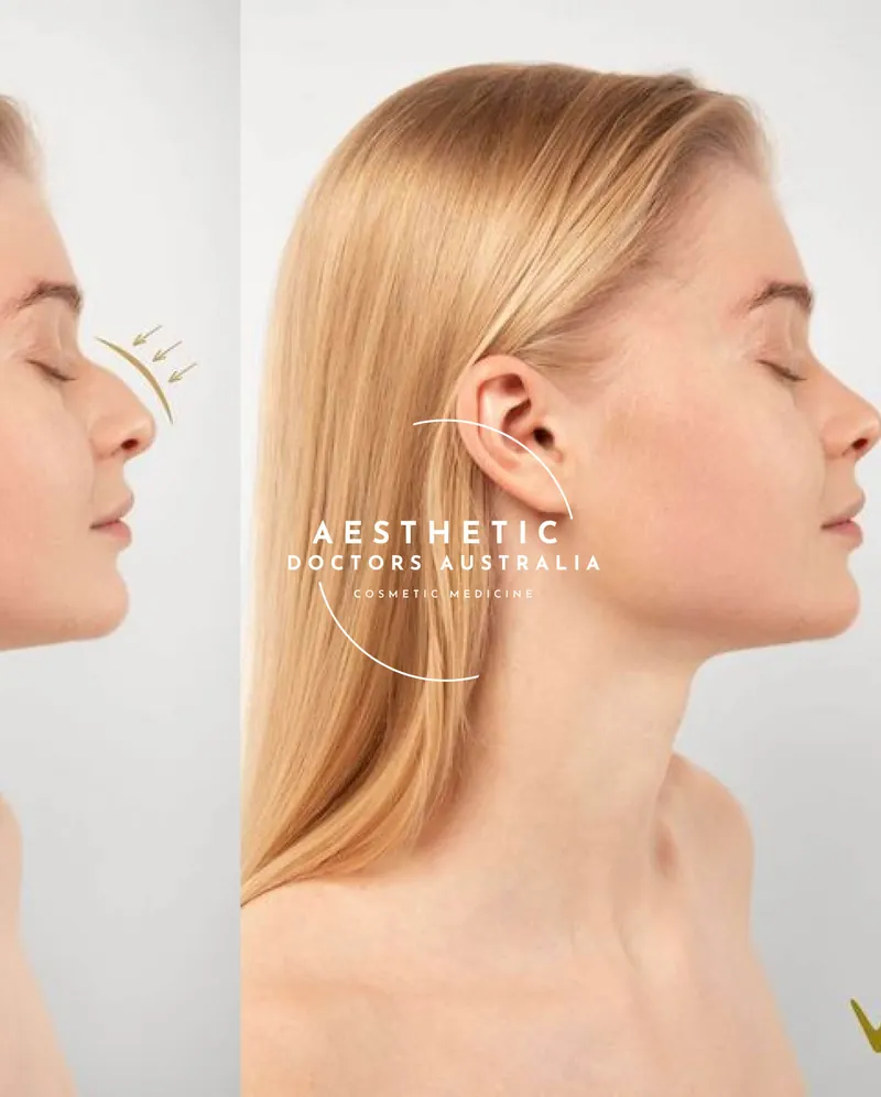 face and neck treatments at aesthetic doctors australia