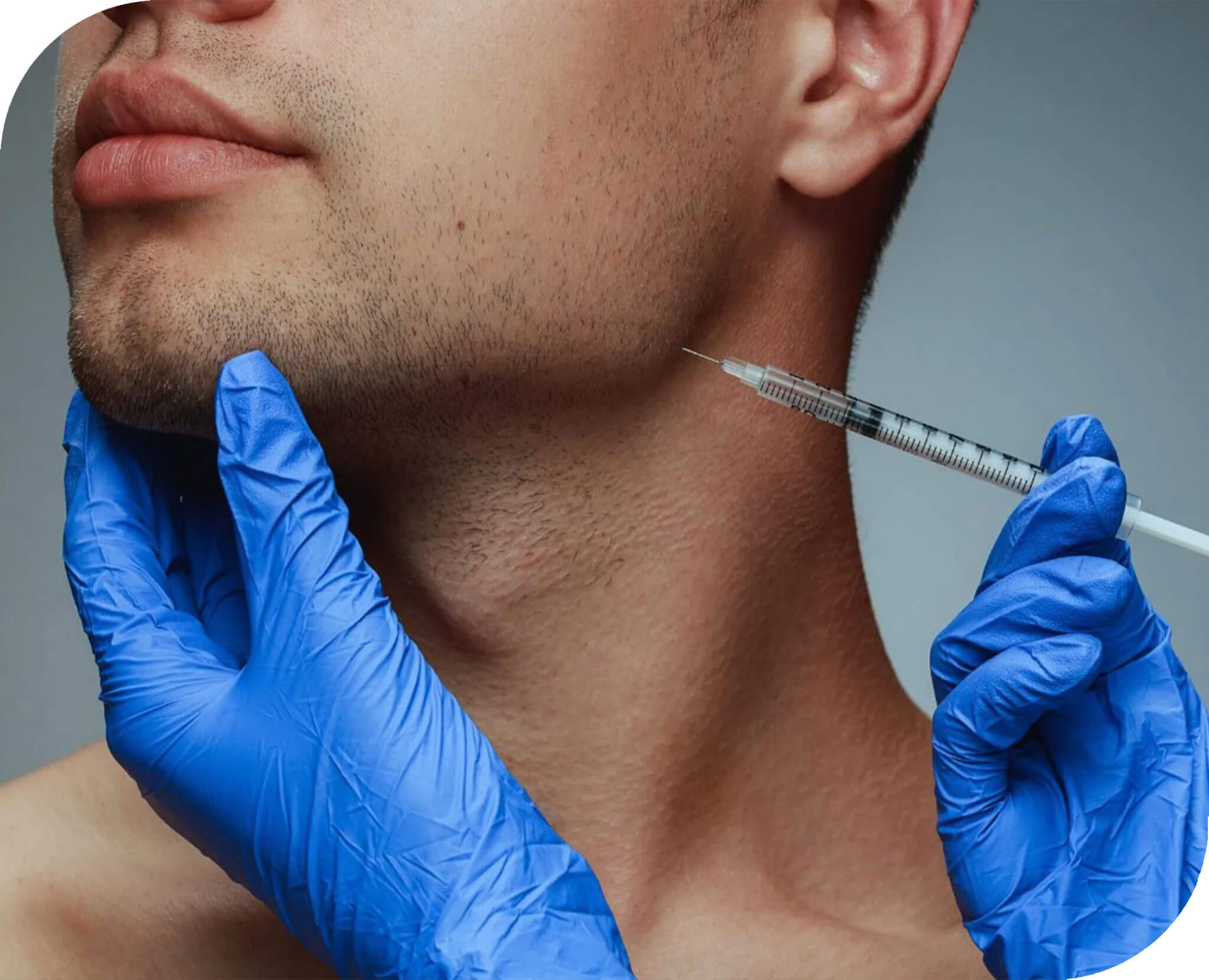 Injection placed into the masseter at the angle of the jaw